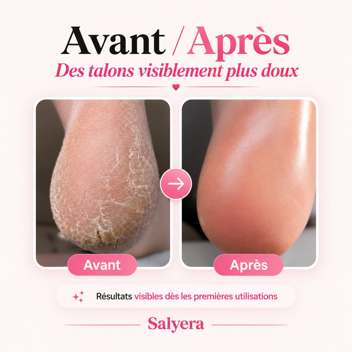 Râpe éléctrique pédicure express - Salyera